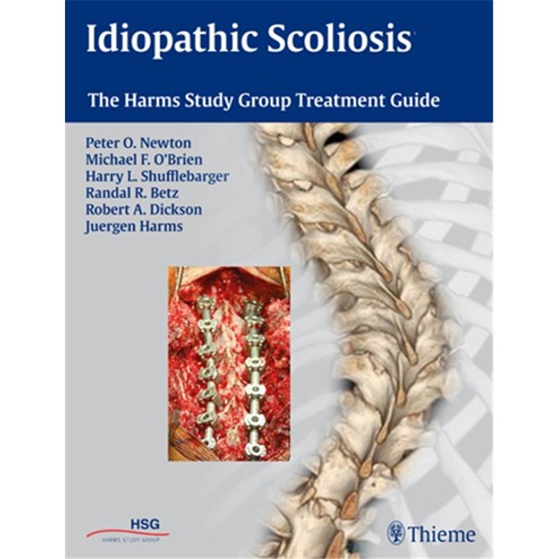 Idiopathic Scoliosis - The Harms Study Group Treatment Guide